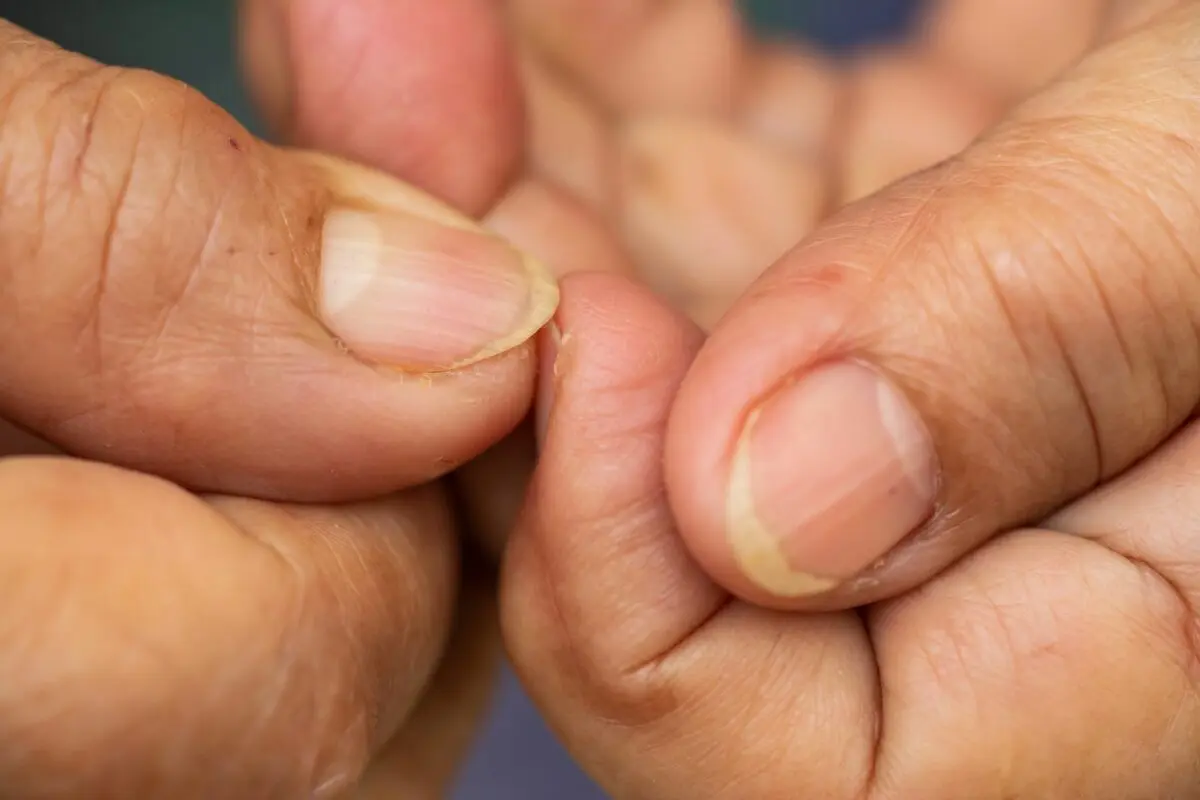 Why nails turn yellow and what to do about it