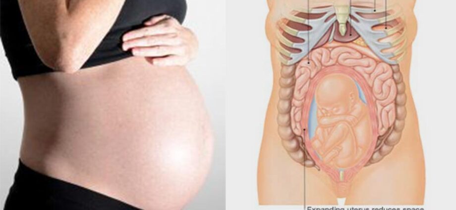 Why ribs hurt during pregnancy