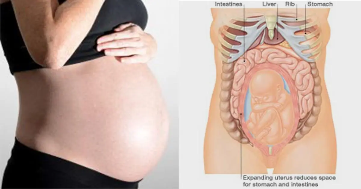 Why ribs hurt during pregnancy
