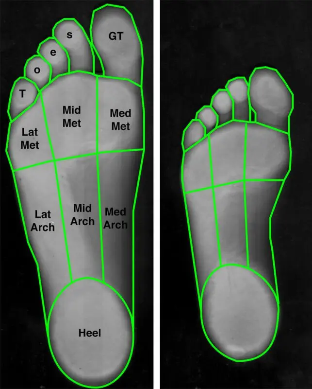 Why the soles of the feet are burning: the reason and how to get rid of