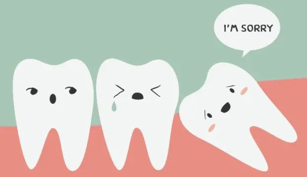 Wisdom tooth extraction: expert advice