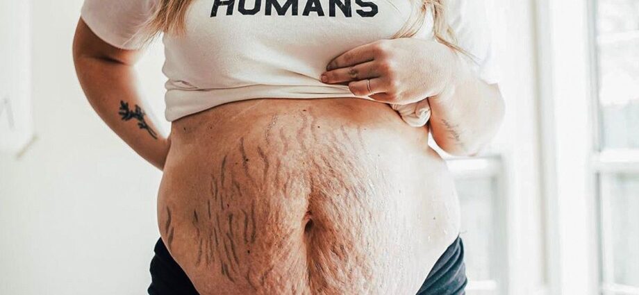 Woman&#8217;s body after childbirth