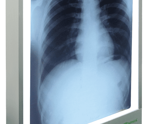 Рентгеновская пленка для просмотра: для чего нужна, когда используется?