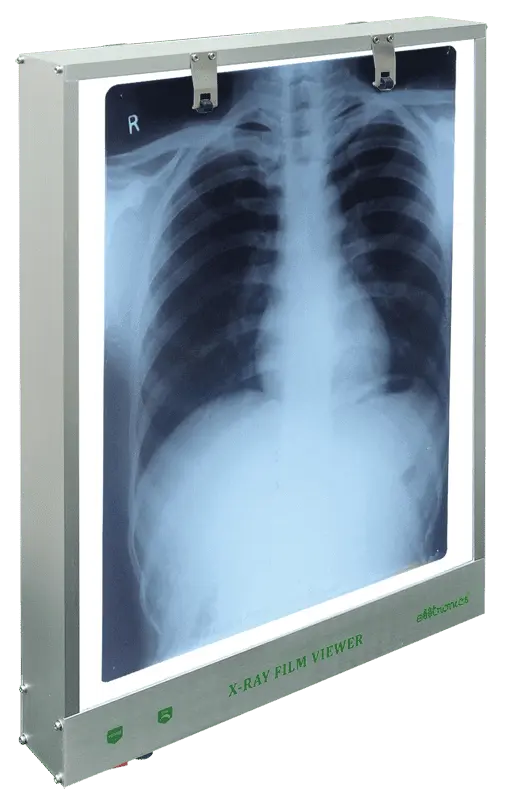 X-ray film viewer: what is it for, when is it used?