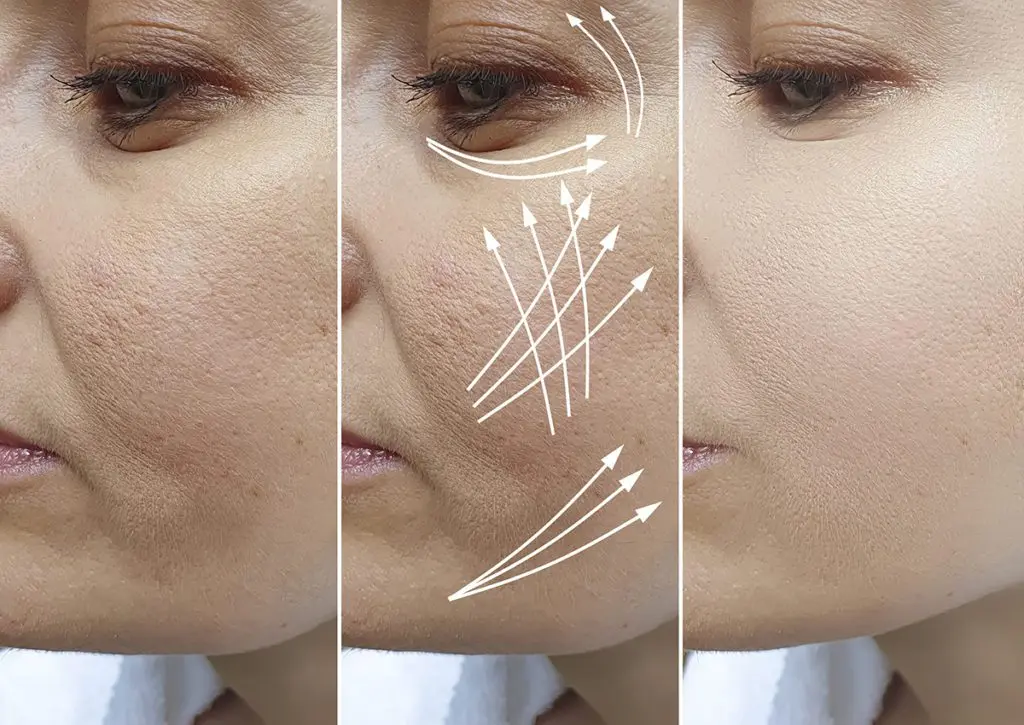 Youthful skin without injections