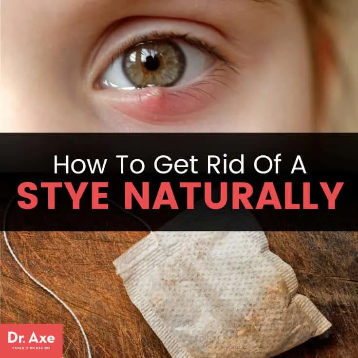 How to cure a stye naturally and quickly? &#8211; Happiness and health