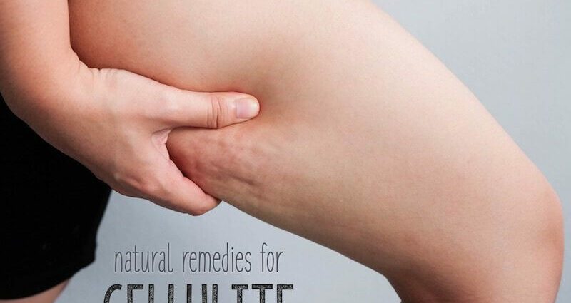 How to deal with cellulite at home