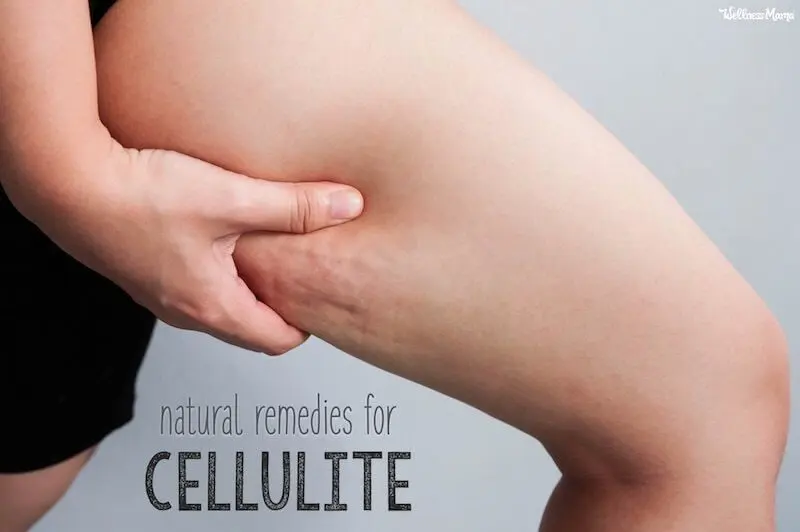 How to deal with cellulite at home