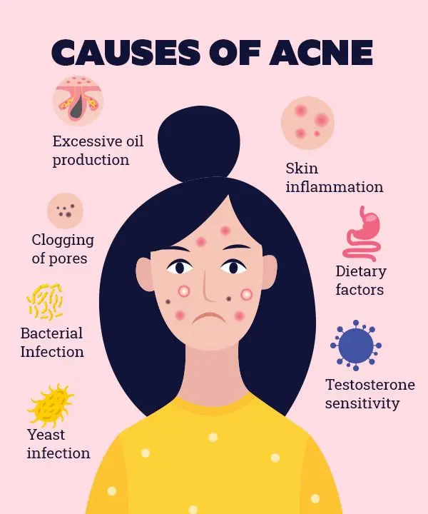 How to get rid of acne: tips that come in handy