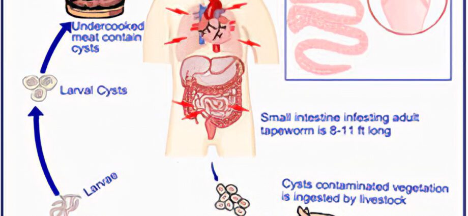 Tapeworm: tohumate me nga maimoatanga - te hari me te hauora
