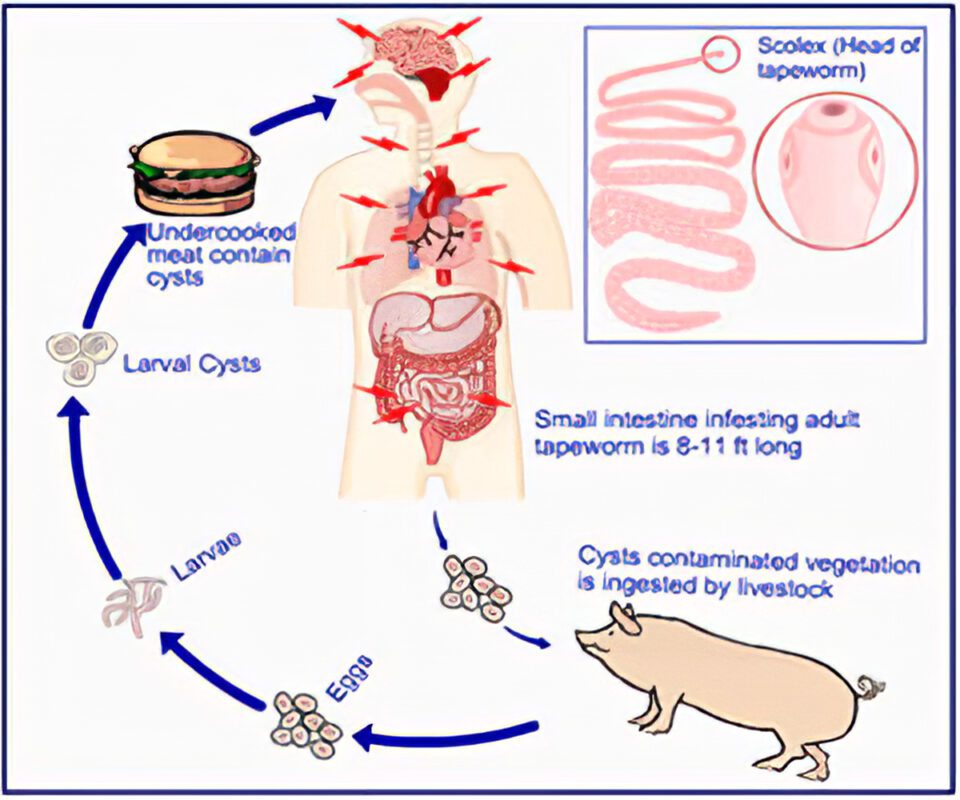 Tapeworm Symptoms And Treatments Happiness And Health Healthy Food Near Me