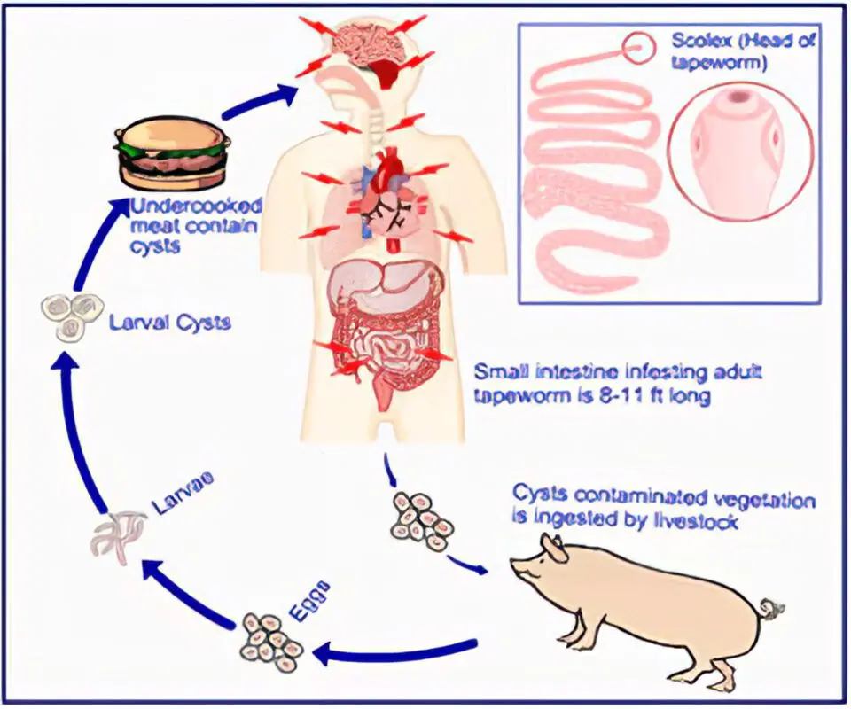 Tapeworm: symptoms and treatments &#8211; happiness and health