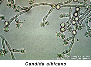 Treating candida albicans: the 3% natural 100-step method &#8211; Happiness and health
