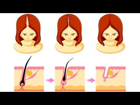 What affects hair growth: main factors, video