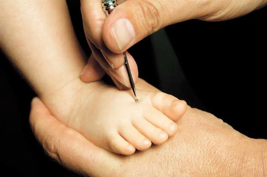 Acupuncture for babies