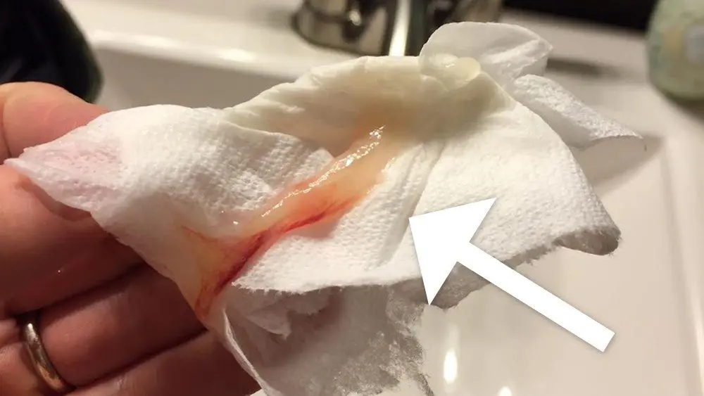 All about the mucous plug