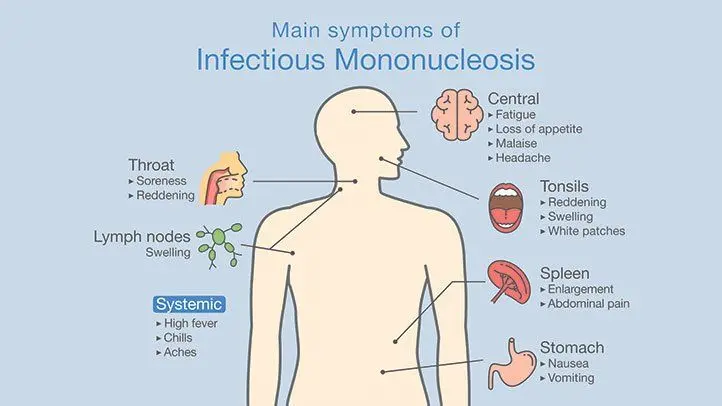 all-you-need-to-know-about-mononucleosis-in-children-healthy-food-near-me