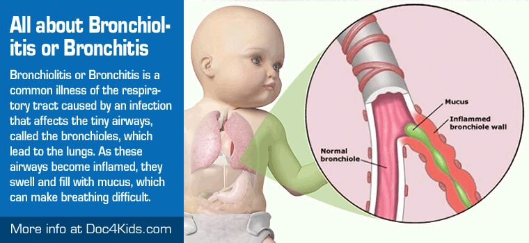 Baby has bronchitis