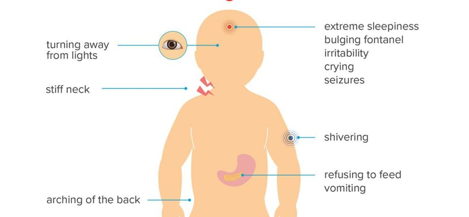 Baby has meningitis