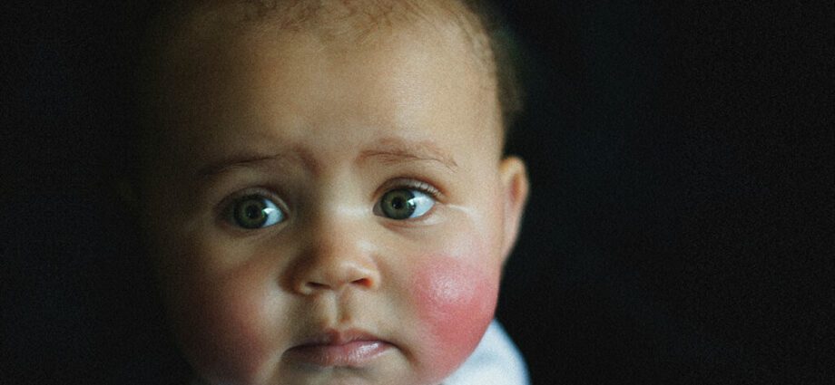 Beba je crvena: sve što trebate znati da biste ga zaštitili