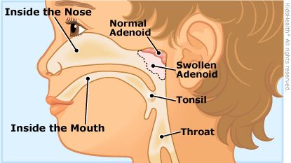 Baby&#8217;s adenoids: role and definition