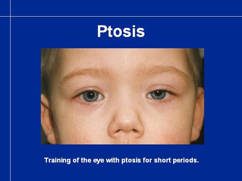 Baby&#8217;s vision: preventing and detecting eye problems in your child