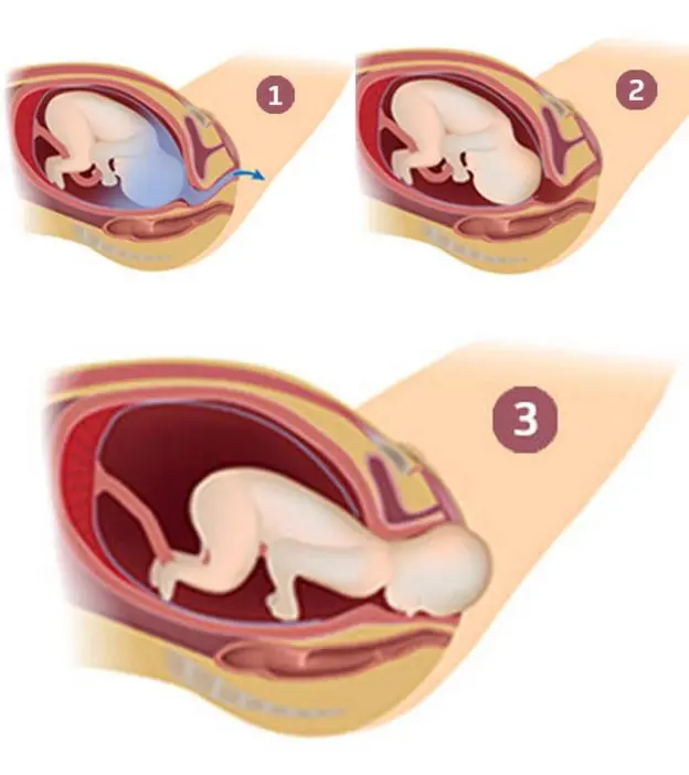 Childbirth: all the baby&#8217;s positions