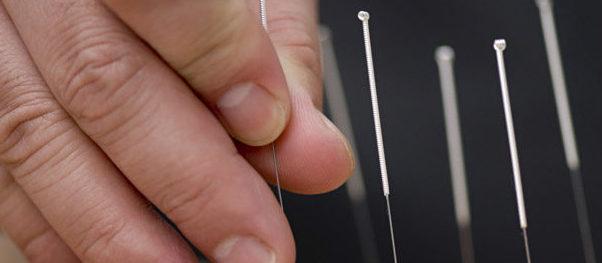 Childhood eczema: what if we tried acupuncture?