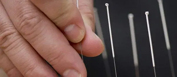 Childhood eczema: what if we tried acupuncture?