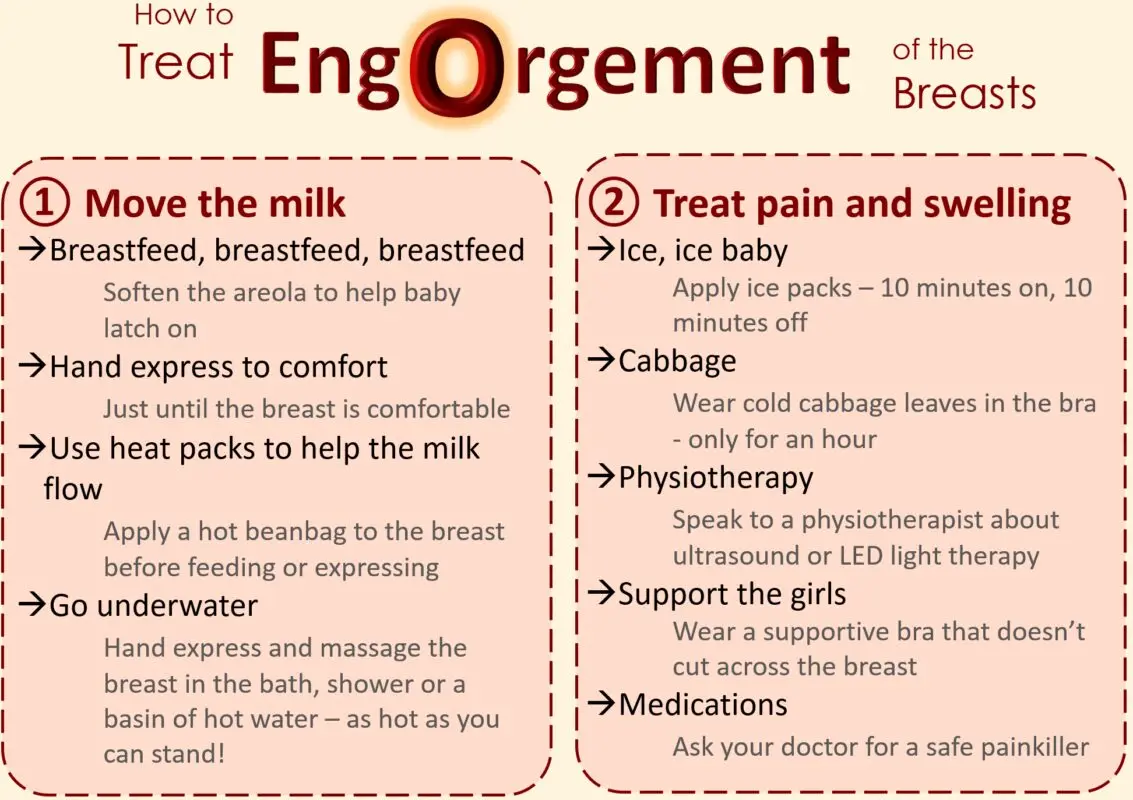 Crevasse, engorgement: common breastfeeding problems