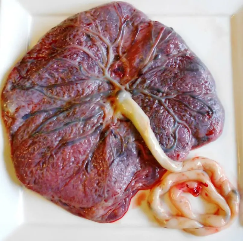 Eating your placenta: a practice that is the subject of debate