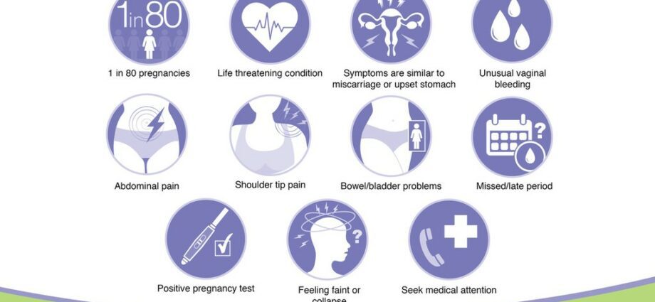 Ectopic pregnancy: symptoms that should alert