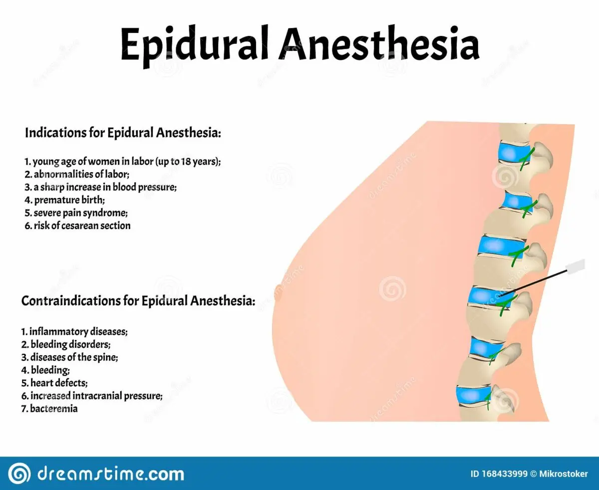 Epidural: what are the contraindications?