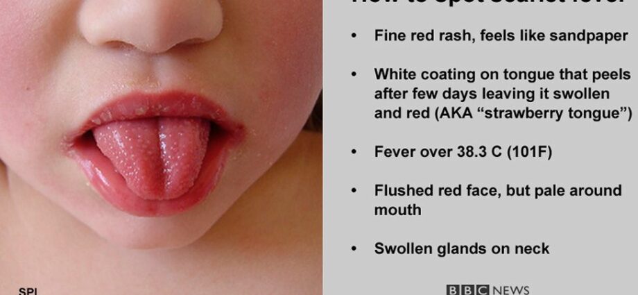 Everything about scarlet fever in babies