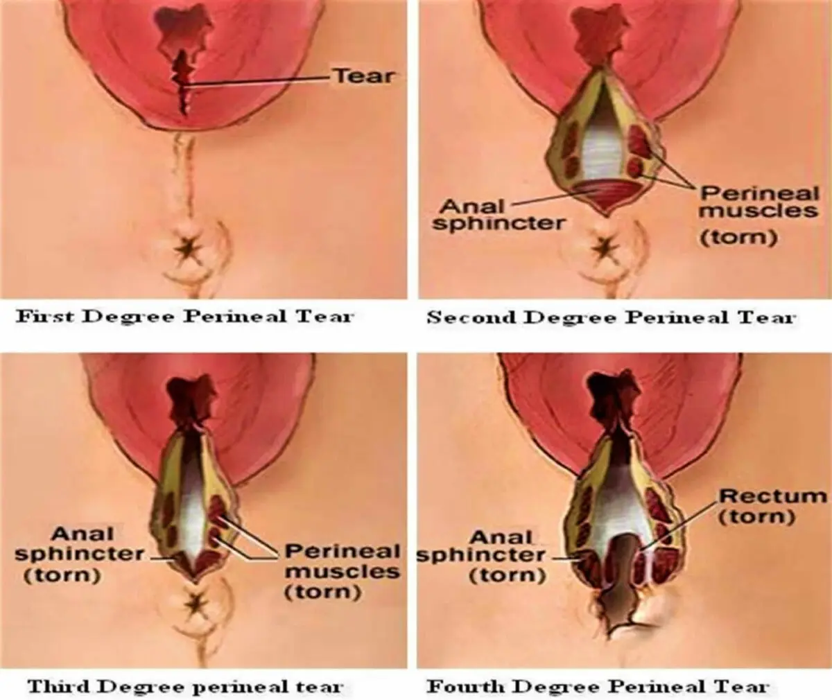 Everything about the perineum