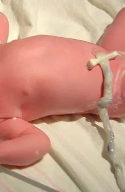 Everything about the umbilical cord