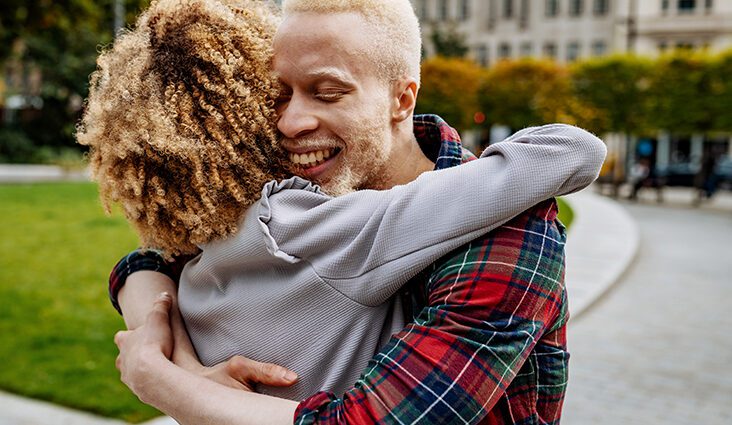 Kõik, mida pead teadma laste albinismi kohta