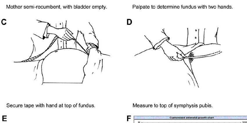 Fundal height: all about measuring fundal height