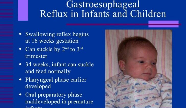 Gastrooesophagealis reflux betegség (GERD) baba: okok, tünetek, kezelések