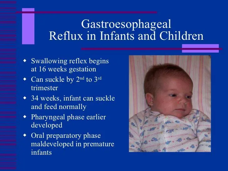 Gastroesophageal Reflux Disease (GERD) Baby: Causes, Symptoms, Treatments