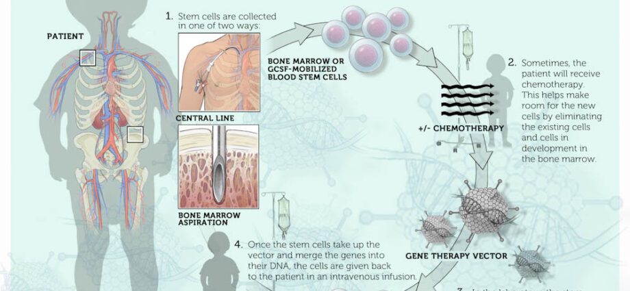 Gene therapy in children