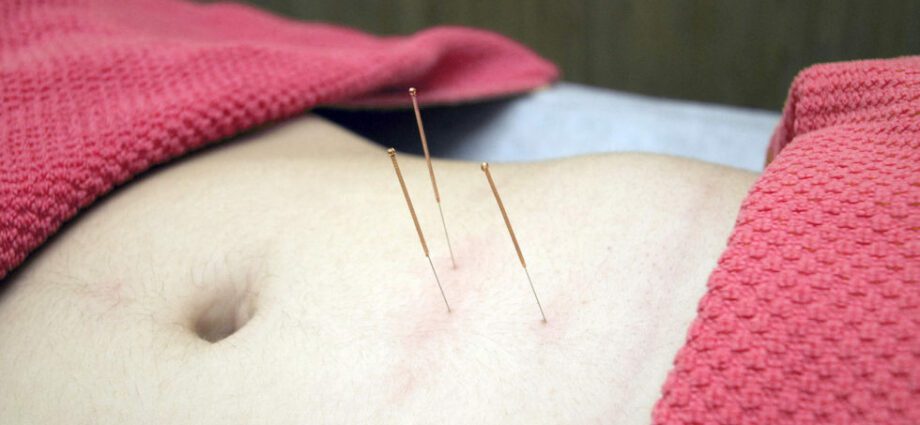 Growth pain: what if you tried acupuncture?