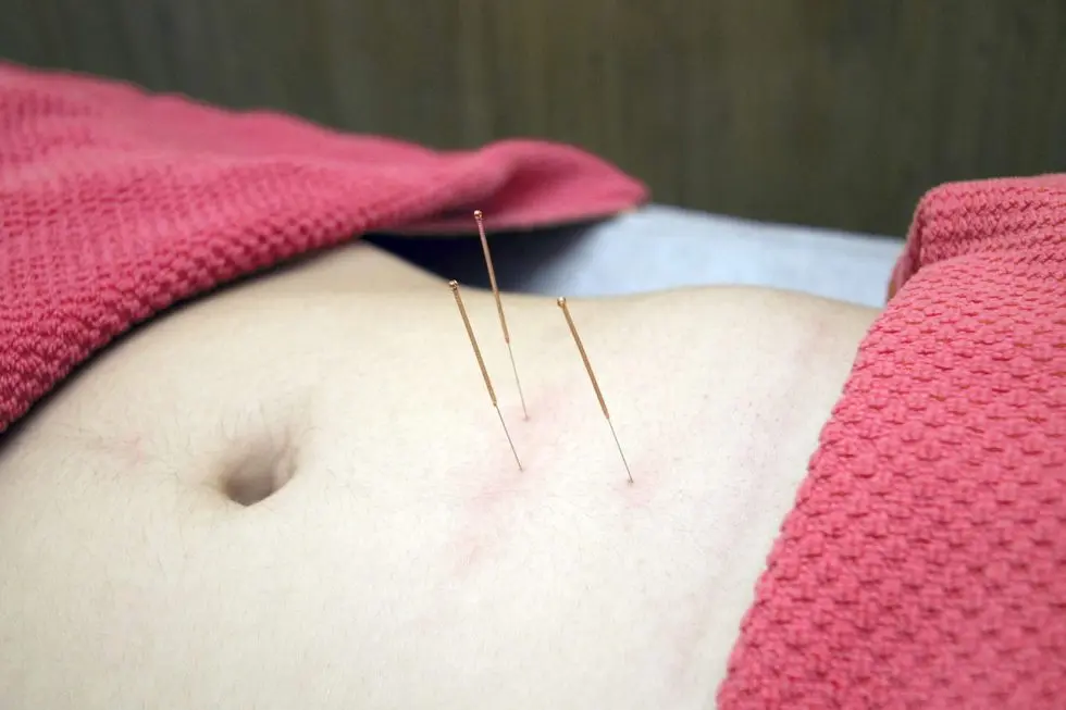 Growth pain: what if you tried acupuncture?