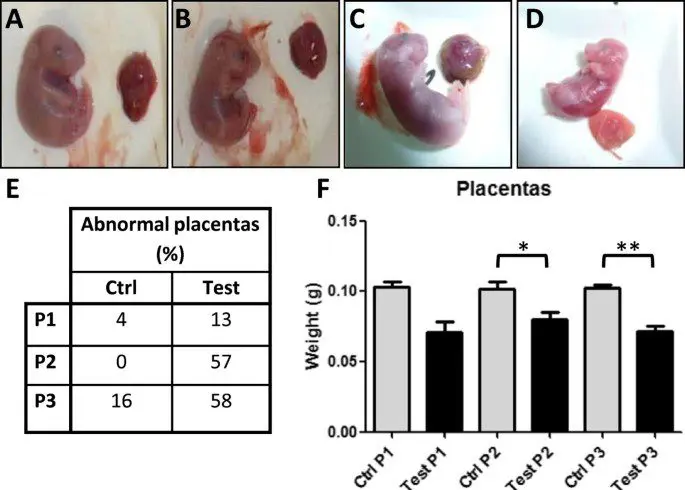 Growth retardation in utero: “small weights” under close surveillance