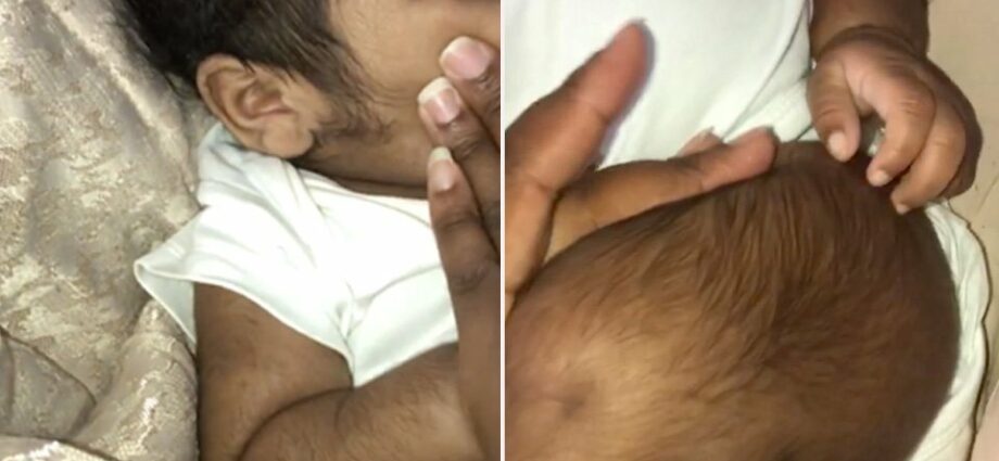 Bebé "peludo" ao nacer: zoom no lanugo