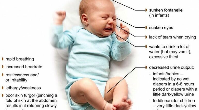 How to recognize dehydration in the baby?