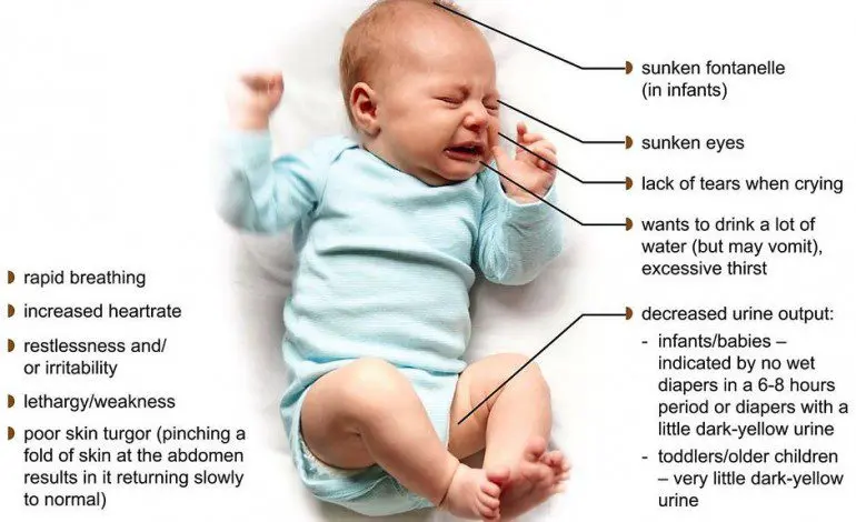 How to recognize dehydration in the baby?