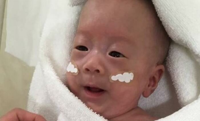 Japanese baby born at 268g was released from hospital