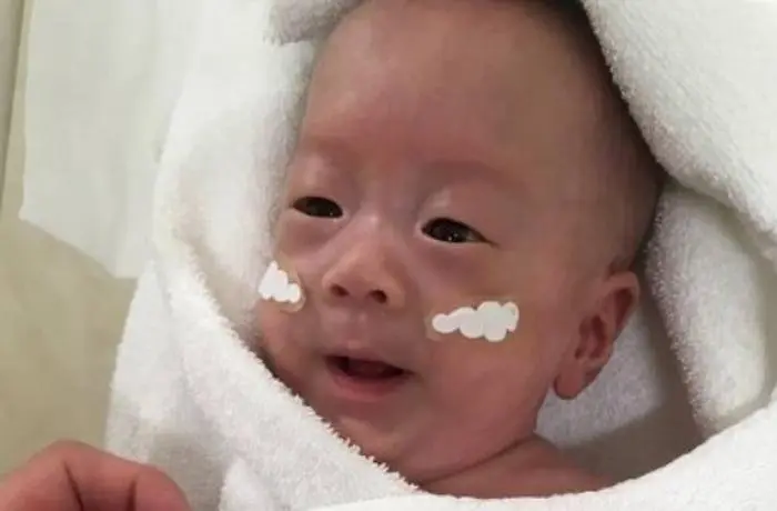 Japanese baby born at 268g was released from hospital