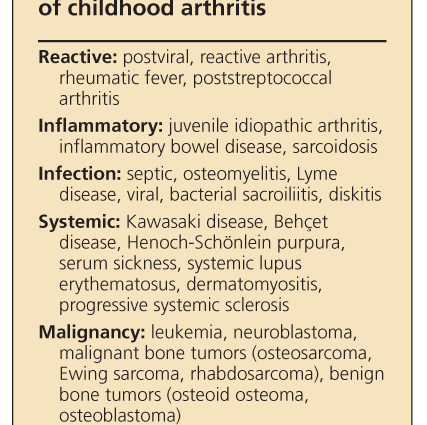 Moje dijete ima juvenilni idiopatski artritis: dijagnoza, simptomi i liječenje